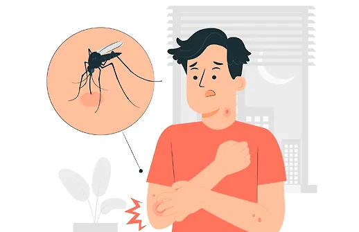 همه چیز درباره تب دنگی و پشه آئدس + علائم و راههای پیشگیری